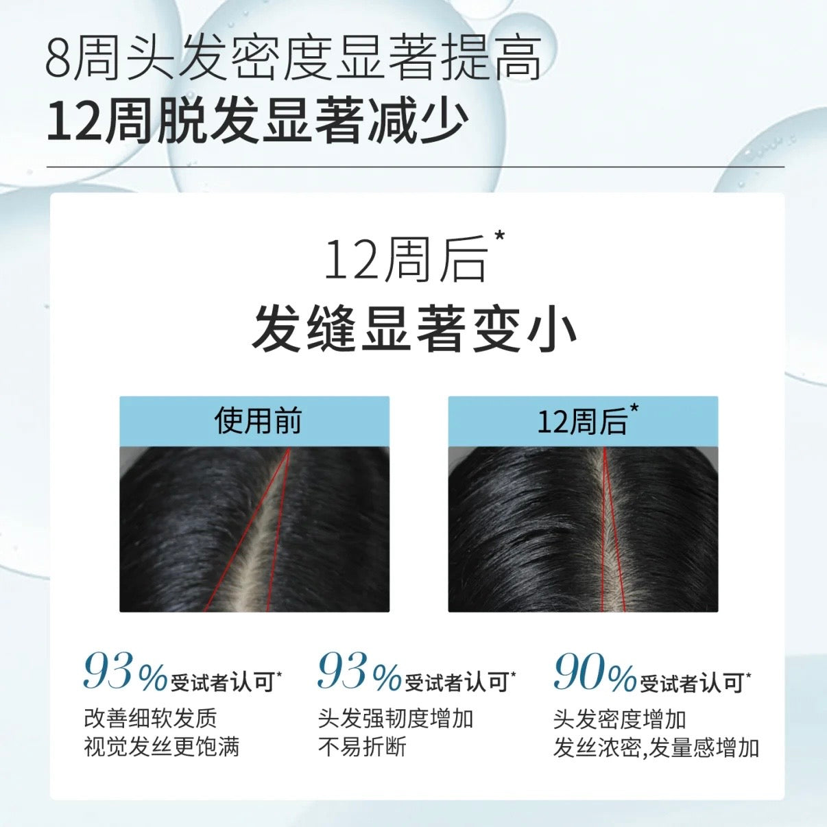 FORTRO Anti-Thinning & Refreshing Shampoo